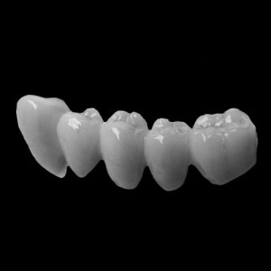 bridge_web DentalBridge