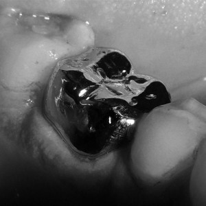 crown_web Crown