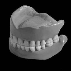 dentures_web Dentures
