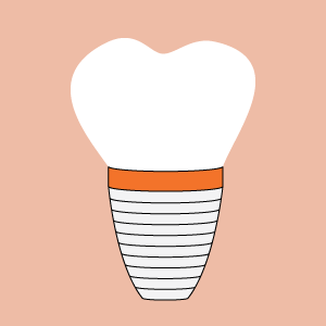 implantdentistry_orange ImplantDentistry