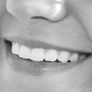 whitening_web Whitening